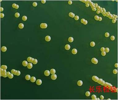醫(yī)藥行業(yè)：人體存有金黃色葡萄球菌為正?，F(xiàn)象